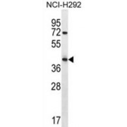 Arrestin Domain-Containing Protein 5 (ARRDC5) Antibody