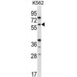 Recombination Activating Gene 2 (RAG2) Antibody