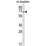 Eyes Absent Homolog 1 (EYA1) Antibody