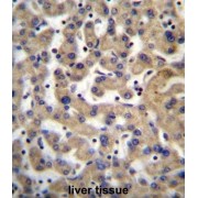 Pyruvate Dehyrogenase Phosphatase Catalytic Subunit 1 (PDP1) Antibody