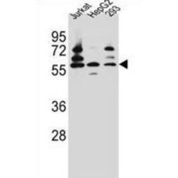 Pyruvate Dehyrogenase Phosphatase Catalytic Subunit 1 (PDP1) Antibody