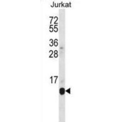 DNA-Directed RNA Polymerase II Subunit RPB7 (POLR2G) Antibody