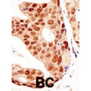 Protein Inhibitor of Activated STAT3 (PIAS3) Antibody