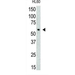 Protein Inhibitor of Activated STAT3 (PIAS3) Antibody