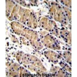 WAP Four Disulfide Core Domain Protein 1 (WFDC1) Antibody