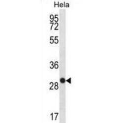 WAP Four Disulfide Core Domain Protein 1 (WFDC1) Antibody