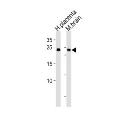 Sex Determining Region Y Box Protein 15 (SOX15) Antibody