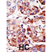 Protein Inhibitor of Activated STAT2 (PIAS2) Antibody