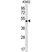 Coiled-Coil Domain-Containing Protein 71 (CCDC71) Antibody