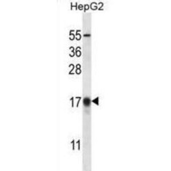 Microtubule-Associated Proteins 1A/1B Light Chain 3B (APG8b) Antibody