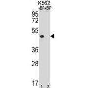 Olfactory Receptor Family 8 Subfamily K Member 3 (gene/pseudogene) (OR8K3) Antibody