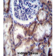 Hyaluronidase-2 (HYAL2) Antibody