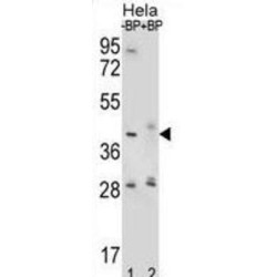 Hyaluronidase-2 (HYAL2) Antibody