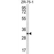 Myogenin (MYOG) Antibody