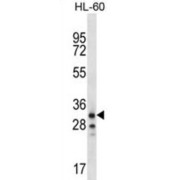 Olfactory Receptor Family 6 Subfamily K Member 2 (OR6K2) Antibody