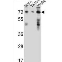 Peroxisomal Multifunctional Enzyme Type 2 (HSD17B4) Antibody