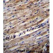 tRNA-Dihydrouridine Synthase 1-Like (DUS1L) Antibody