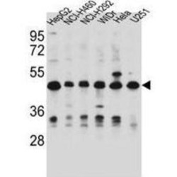 tRNA-Dihydrouridine Synthase 1-Like (DUS1L) Antibody