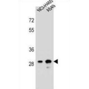 Putative Dehydrogenase/reductase SDR Family Member 4-Like 1 (DHRS4L1) Antibody