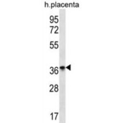 Olfactory Receptor 8D4 (OR8D4) Antibody