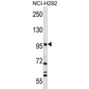 Prolyl Endopeptidase FAP (FAP) Antibody