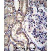 Stromal Interaction Molecule 2 (STIM2) Antibody