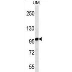 Stromal Interaction Molecule 2 (STIM2) Antibody