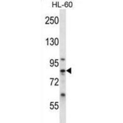 Calpain-6 (CAPN6) Antibody