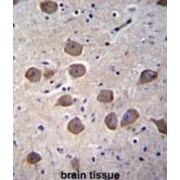 Catenin Delta 2 (CTNND2) Antibody