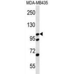 Catenin Delta 2 (CTNND2) Antibody