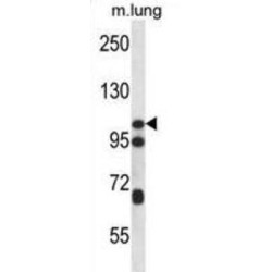 Catenin Delta 2 (CTNND2) Antibody