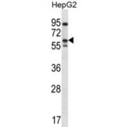 ERBB Receptor Feedback Inhibitor 1 (ERRFI1) Antibody