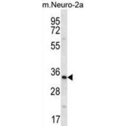 Peroxisomal Biogenesis Factor 14 (PEX14) Antibody