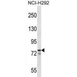 Mlx Interacting Protein-Like (MLXIPL) Antibody