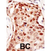 E3 Ubiquitin-Protein Ligase CBL-C (CBLC) Antibody