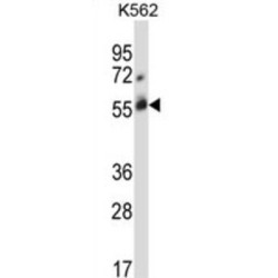 E3 Ubiquitin-Protein Ligase CBL-C (CBLC) Antibody