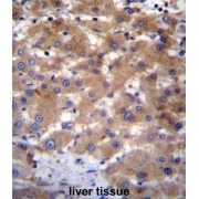 Putative Ubiquitin-Conjugating Enzyme E2 N-Like (UBE2NL) Antibody