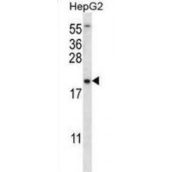 Putative Ubiquitin-Conjugating Enzyme E2 N-Like (UBE2NL) Antibody