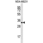 LIX1L Antibody