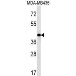 Glia Derived Nexin / GDN (SERPINE2) Antibody