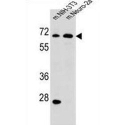 Malic Enzyme 2, NADP+ Dependent, Mitochondrial (ME2) Antibody