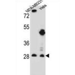 Eukaryotic Translation Initiation Factor 4H (EIF4H) Antibody