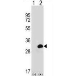 Carbonic Anhydrase 1 (CA1) Antibody