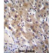 Fibrinogen Like Protein 1 (FGL1) Antibody