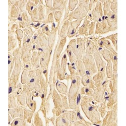 Procollagen Lysine-1,2-Oxoglutarate-5-Dioxygenase 1 (PLOD1) Antibody