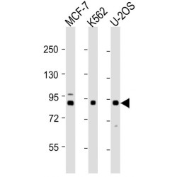 Procollagen Lysine-1,2-Oxoglutarate-5-Dioxygenase 1 (PLOD1) Antibody