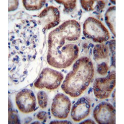 Iron-Responsive Element Binding Protein 2 (IREB2) Antibody