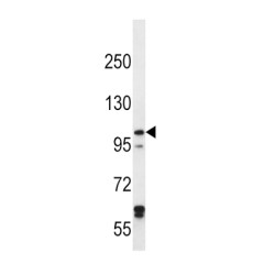 Iron-Responsive Element Binding Protein 2 (IREB2) Antibody