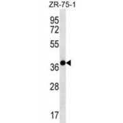 WB analysis of ZR-75-1 cell lysates.