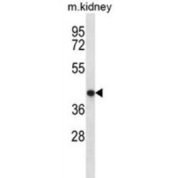 Tenomodulin (TNMD) Antibody